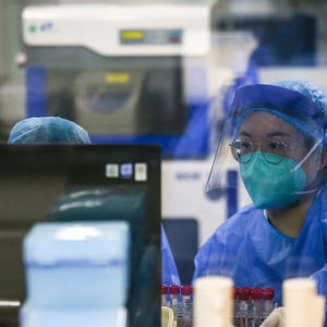 Cas 518-47-8 уранин/Флуоресцеин натрия - Product Image 5