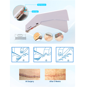 <span class=keywords><strong>Stapler</strong></span> Kulit Medis Steril Manual Sekali Pakai 35W Instrumen Bedah Hewan - Product Image 6