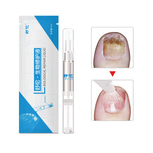 Buona Efficace A Base di Erbe Punta Infezione Onicomicosi Paronychia Nail FungusTreatment Penna Per Anti Fungine Delle Unghie - Product Image 4