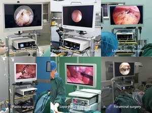 Endoscopio Electrónico Full HD, Endoscopio Médico para Ureteroscopio, Artroscopio y Torre Laparoscópica - Product Image 6