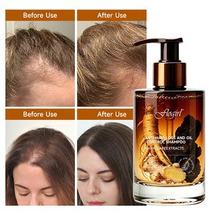 OEM ODM Anti-Oily Scalp Anti Hair Fall <strong>Shampoo</strong> Ginseng Extract Hair Growth Treatment <strong>Shampoo</strong> for Men <strong>Women</strong> - Product Image 3