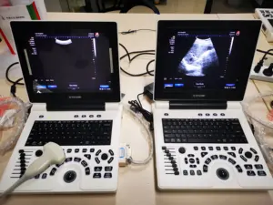 Goedkoopste Medische Volledig Digitale Draagbare B/W 3d Zwart-Witte Ultrasone Scanner