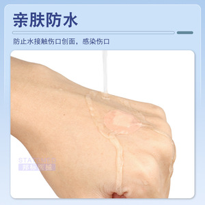 Pansement adhésif médical imperméable et respirant Anqisheng 22 mm pour le soin des plaies - Product Image 5
