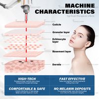 Perfectlaser Máquina de Eliminación de Tatuajes con Láser Nd Yag Q-Switched y Pico Láser, Alcance de Cabezal de 110 cm, Ángulo de Alas de 100 Grados, Alcance de Elevación