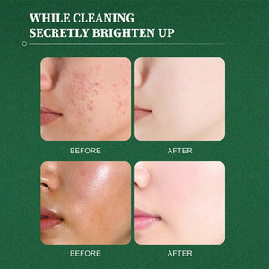 Nettoyant moussant pour le visage au riz 100 ml OEM/ODM avec tête anti-acné, nettoyage en profondeur des pores, resserrement des pores, nettoyant pour le visage blanchissant au riz - Product Image 6