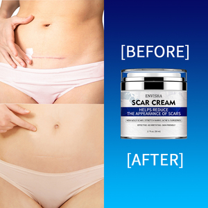 Crème <span class=keywords><strong>hydratante</strong></span> pour le visage de haute qualité, efficace, rajeunissante, <span class=keywords><strong>hydratante</strong></span>, soin de la peau du visage pour femmes, crème réparatrice de cicatrices - Product Image 3