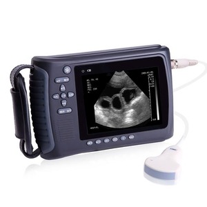 Appareil d'échographie vétérinaire pour la détection <span class=keywords><strong>de</strong></span> la gestation - Système portable <span class=keywords><strong>de</strong></span> surveillance du bétail haute définition - Product Image 1