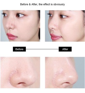 <span class=keywords><strong>Appareil</strong></span> de nettoyage facial profond Sonic EMS Frequency Removal Blackhead Dirty Pore Clean, spatule exfoliante <span class=keywords><strong>pour</strong></span> la peau - Product Image 4