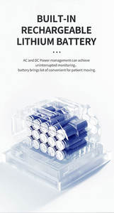 Медицинский многопараметрический монитор пациента CONTEC CMS8000-1: портативный, высококачественный, для больниц и скорой помощи, с функцией ЭКГ - Product Image 5