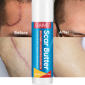 Оптовая продажа: Бальзам ELAIMEI для быстрого восстановления кожи после шрамов, быстро впитывающаяся мазь для удаления рубцов, силиконовый стик от шрамов для лица и тела - Product Image 1