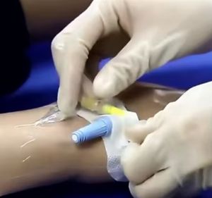 Alat perekat sekali pakai, perangkat keamanan berperekat 3cm x 9cm dengan pegangan kunci PICC CVC <span class=keywords><strong>IV</strong></span> tabung infus - Product Image 1