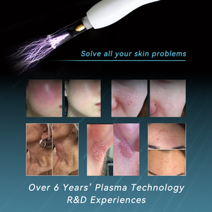 2025 Neu Innovative Anti-Aging-Falten maschinen Kollagen wachstum Gesichts verjüngung ionisierte Gas Hals Haut Straffung gerät - Product Image 3