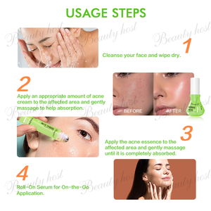 効果的な天然ハーブエキスアンチアクネキット2PCSクリーム50Gロールオンセラム15MLニキビ除去スキンケアセット - Product Image 5