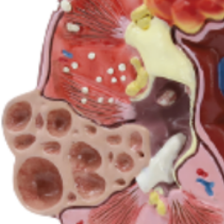 Modelo de Riñón de Tamaño Natural ADA de Doble Cara (Normal y con Patologías) A739, Modelo Anatómico para Ciencias Médicas y Escuelas - Product Image 3