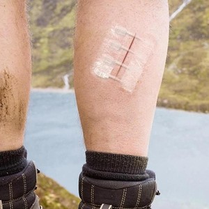 แผ่นปิดแผลแบบซิป <span class=keywords><strong>3</strong></span> ชิ้น/ชุด แผ่นปิดแผลห้ามเลือด ปิดแผลเร็ว แผ่นปิดแผลแบบซิป แผ่นปิดแผลแบบกำหนดเอง - Product Image 2