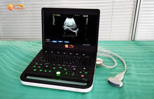 SUN-800C Woman Pregnancy Ultrasound Scanner <strong>Ecography</strong> Laptop Digital USG Diagnostic PW BW Ultrasound Machine - Product Image 3