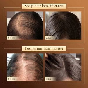 Lápiz labial al por mayor, crea tu propio lápiz labial, productos para <span class=keywords><strong>el</strong></span> cuidado del <span class=keywords><strong>cabello</strong></span> al por mayor Sadoer, productos naturales orgánicos de ciprés para <span class=keywords><strong>el</strong></span> crecimiento del <span class=keywords><strong>cabello</strong></span> y contra la caída del <span class=keywords><strong>cabello</strong></span>. - Product Image 6