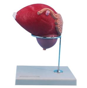 Modelo <span class=keywords><strong>de</strong></span> Agrandamiento <span class=keywords><strong>de</strong></span> <span class=keywords><strong>la</strong></span> <span class=keywords><strong>Vejiga</strong></span> Masculina del Sistema Genitourinario, Modelo Estructural con Orificios Uretrales y Glándula Prostática - Product Image 3