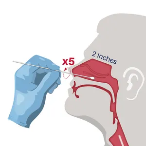 Diagnostischer Test Virus Nase Nasopharyngeale Proben entnahme Probenahme Beflock ter Nasen tupfer