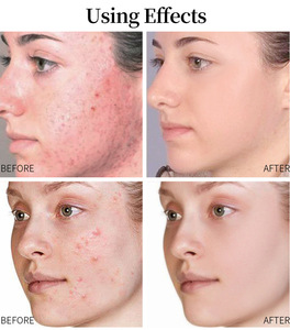 เซรั่มบำรุงผิวหน้าคอลลาเจนเหลวต่อต้านริ้วรอยช่วยให้ผิวขาวปรับแต่งโลโก้ได้ตามต้องการ - Product Image 6