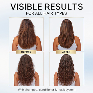 Set <span class=keywords><strong>de</strong></span> Productos Profesionales para el Cuidado del Cabello, Marca Privada, Champú y Acondicionador con Aceite <span class=keywords><strong>de</strong></span> Romero para Nutrir, Engrosar y Estimular el Crecimiento del Cabello - Product Image 2