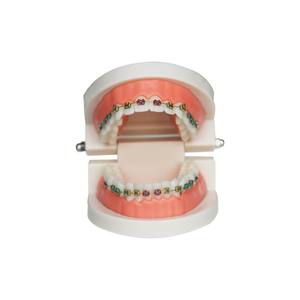 Orthodontic Dental <b>Model</b> for Display Electric Power Source Resin Material with Metal-Ceramic Comparison Bracket Archwire - Product Image 1