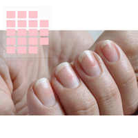 Patchs à ongles innovants de différentes tailles pour tous les doigts, patchs réparateurs d'ongles, gel hydrocolloïde nourrissant, autocollants anti-crevasses pour les ongles