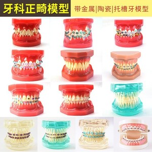 Modelo de Ortodoncia Dental Serie HST B6 con Aparatos para Práctica y Enseñanza - Product Image 3
