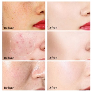 FATAZEN Organic Private Label BB Royal Face Cream Antienvejecimiento Blanqueamiento Hidratante Pigmentado Face Eraser Royal Cream Foundation - Product Image 2