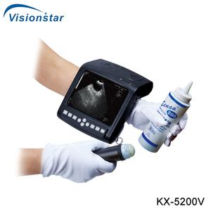 Sistema de Ultrasonido Veterinario Portátil KX-5200 a <span class=keywords><strong>Precio</strong></span> Económico - Product Image 3