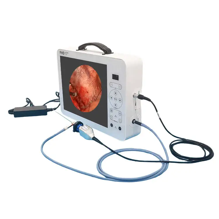 Медицинская hd Эндоскопическая Камера, Лапароскопическая хирургическая камера full hd, оборудование для камеры