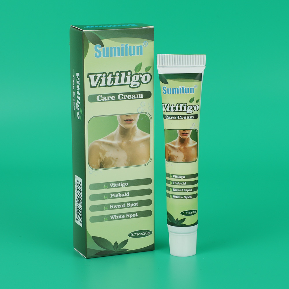 Hot sell White Spot Vitiligo Treatment Cream Herbal Vitiligo Therapeutic Creams Relieve Psoriasis Eczema Vitiligo Ointment