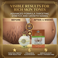 Crème de massage réduisant l'apparence des vergetures avec collagène, huile d'argan, booster d'élastine et beurre de cacao