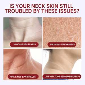 <span class=keywords><strong>Crema</strong></span> de rodillo de cuello de gran oferta de alta calidad, <span class=keywords><strong>crema</strong></span> antienvejecimiento AH-8, <span class=keywords><strong>crema</strong></span> reafirmante para el cuello, <span class=keywords><strong>crema</strong></span> para el cuidado de la piel - Product Image 4