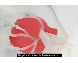 Simulateur <span class=keywords><strong>de</strong></span> formation en intervention coronaire percutée avec cœur battant pour <span class=keywords><strong>la</strong></span> formation aux procédures interventionnelles cardiovasculaires - Product Image 3