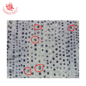 준비된 슬라이드 ascari와 양파 Mitosis 현미경 슬라이드 세트 의료 과학 - Product Image 2