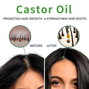 Großhandel 200ml Rosmarin-Haaröl Haarstärkung Haarpflege Rosmarinöl Regelmäßige Anwendung Reines Rosmarin-Haaröl - Product Image 4