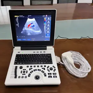 Hastane renkli Doppler ultrason M mod CW kritik bakım ve acil tıp İnsan