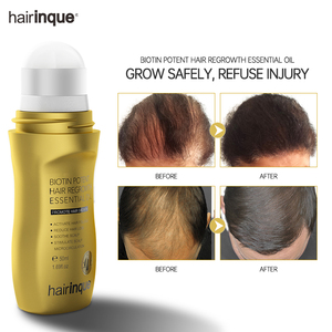 <strong>Biotin</strong> <strong>Hair</strong> Growth <strong>Oil</strong> Fast <strong>Hair</strong> Regrowth Serum Organic <strong>Hair</strong> Growth <strong>Oil</strong> - Product Image 2