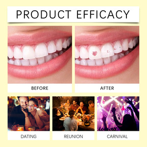 Eelhope Ensemble de décoration en <span class=keywords><strong>diamant</strong></span> à la mode pour les dents scintillantes personnalisées - Product Image 4