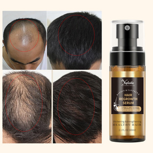 Huile de romarin de marque privée pour la croissance des cheveux Sérum de soin nourrissant du cuir chevelu 60ml Spray de prévention de la perte de cheveux pour des cheveux plus épais - Product Image 3