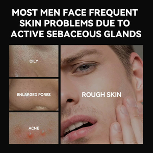 Marque privée Soins du visage anti-acné pour hommes Nettoyant pour le visage Crème nettoyante en profondeur pour hommes - Product Image 4