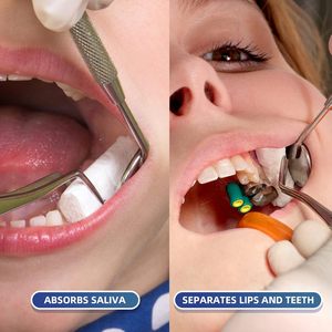 Rol gigi katun sekali pakai, <span class=keywords><strong>Dental</strong></span> penyerap tinggi direkomendasikan dokter gigi untuk merek Yalin - Product Image 2