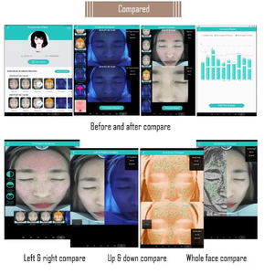 เครื่องวิเคราะห์ผิวหน้าคลินิกความงาม ตรวจจับสิวและเม็ดสี ตรวจจับรังสียูวี ตรวจรูขุมขน ริ้วรอย จุดด่างดำ - Product Image 4