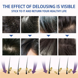 Spray South Moon de 30 ml para la Sarna y los Piojos, Elimina Piojos, Pulgas, Garrapatas, Huevos de Piojos, Alivia la Picazón, el Enrojecimiento y la Hinchazón - Product Image 6