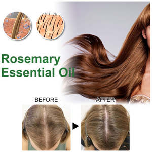 Aceite de Romero EELHOE Anticaída del Cabello, Refrescante y Nutritivo, Esencial para un Cabello Suave y Grueso, Cuidado del Cuero Cabelludo para Cabello Dañado, a Base de Hierbas - Product Image 2