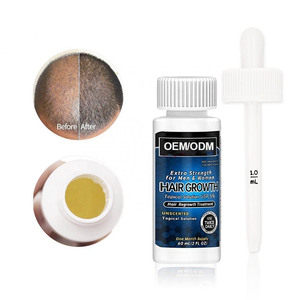 Suero <span class=keywords><strong>para</strong></span> <span class=keywords><strong>el</strong></span> Crecimiento del Cabello, Tratamiento Capilar Orgánico Personalizado OEM de 60 ml, 5% de Aceite <span class=keywords><strong>para</strong></span> <span class=keywords><strong>el</strong></span> Crecimiento del Cabello, Agente Nutritivo y Engrosador, Previene <span class=keywords><strong>la</strong></span> Caída del Cabello - Product Image 3