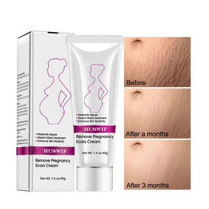 Meilleure qualité sûre effet 7 jours pour les femmes enceintes crème pour l'élimination des vergetures étiquette privée - Product Image 2