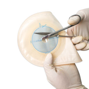 Sacs de stomie médicaux jetables portables de 60 mm non stériles de classe I avec valve pour colostomie – Vente en gros - Product Image 5