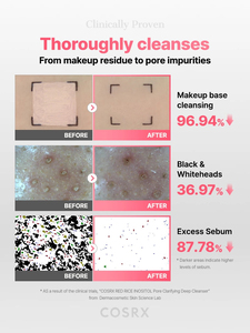 [สำหรับ Afreeca เท่านั้น] [COSRX] ผลิตภัณฑ์ทำความสะอาดผิวหน้า Red Rice Inositol Pore Clarifying Deep Cleanser 150 มล. สำหรับการทำความสะอาดผิวที่มีค่า pH ต่ำและการขจัดความมันส่วนเกิน - Product Image 4